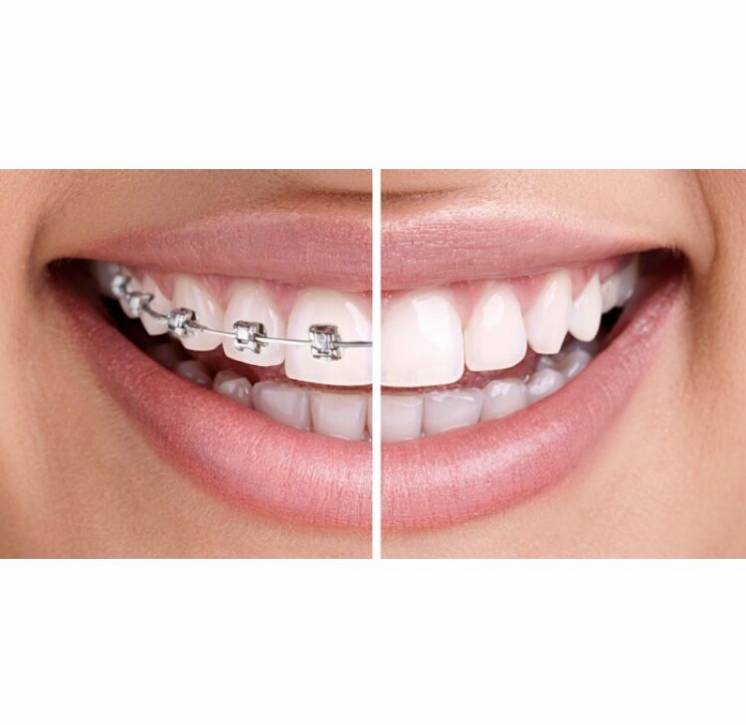 Стоматология Dental-Lux