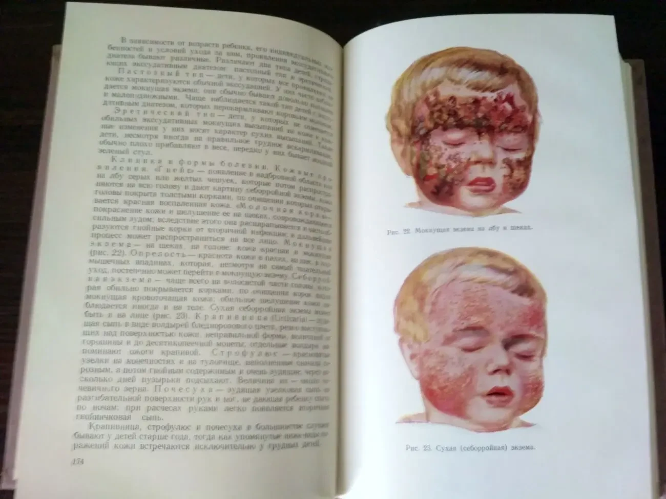 Детские болезни Практическое пособие, медицинский учебник В.А.Власов 9