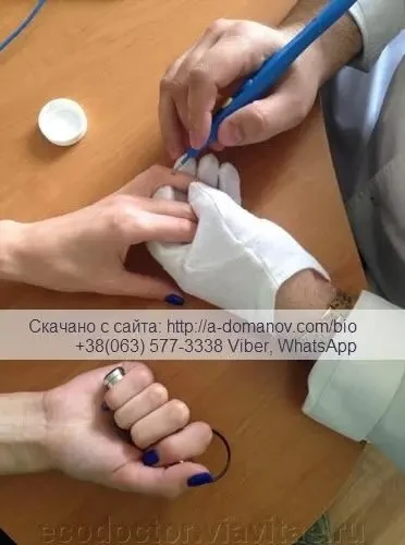 Диагностический прибор Parkes-D Реабилитолог для функционой диагност 3