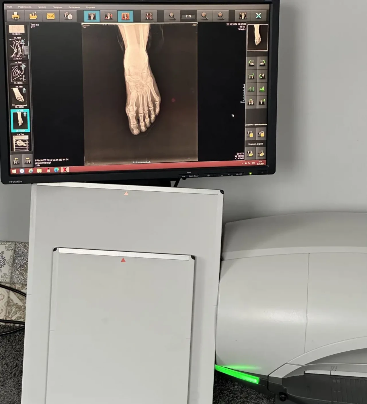 Рентген Дигітайзер Carestream Vita Flex/ 2017/ Оцифровщик знімків CR