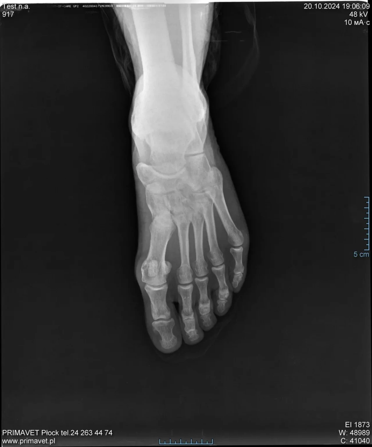 Рентген Дигітайзер Carestream Vita Flex/ 2017/ Оцифровщик знімків CR 3