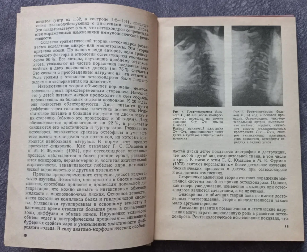 Вестибулярные и слуховые нарушения при шейном остеохондрозе. Бабияк 3