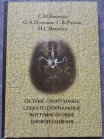 Острые спонтанные супратенториальные внутримозговые кровоизлияния