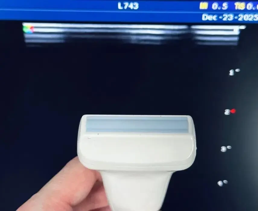 УЗИ УЗД Sonoscape SSI-6000/ Соноскейп/ доплер/ 2х датчики 3