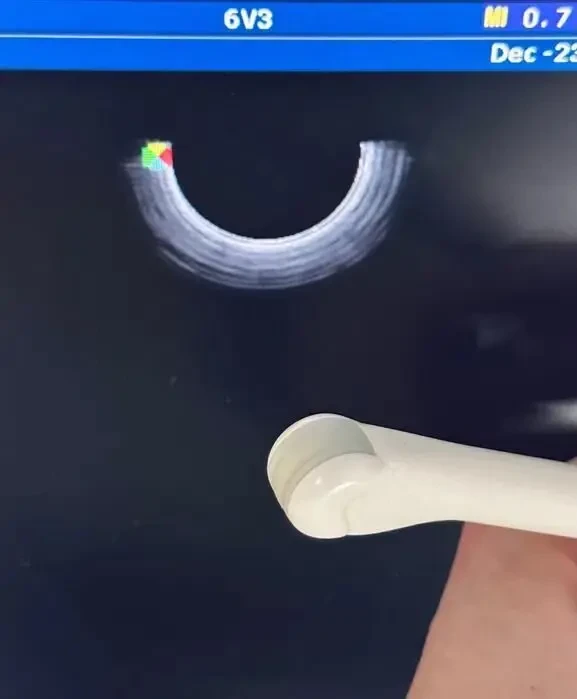 УЗИ УЗД Sonoscape SSI-6000/ Соноскейп/ доплер/ 2х датчики 4