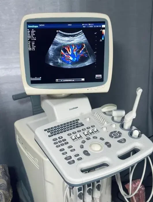 УЗИ УЗД Sonoscape SSI-6000/ Соноскейп/ доплер/ 2х датчики