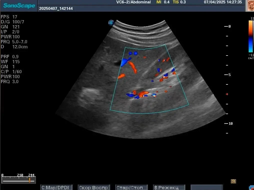 Датчик УЗИ/ УЗД SonoScape C613/ Мікроконвексний (також VC6-2) 2