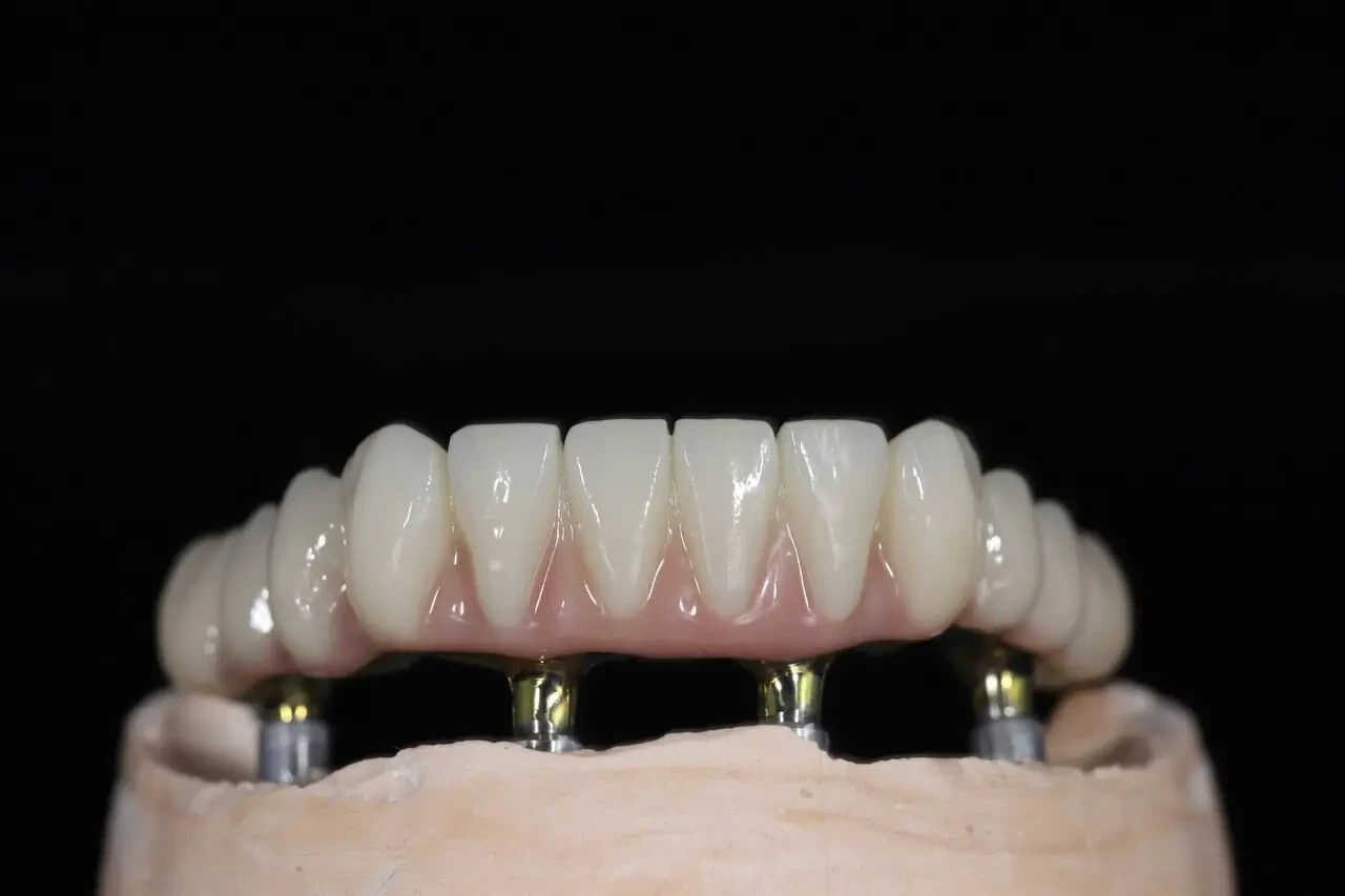 Незнімне протезування,фрезерування о цирконію,Е-мах,CAD/CAM,3Dдрук 4