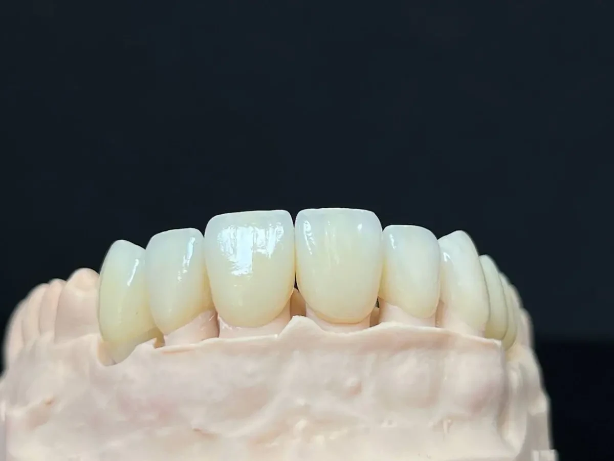 Незнімне протезування,фрезерування о цирконію,Е-мах,CAD/CAM,3Dдрук 2