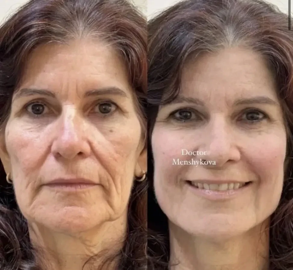 Лікар косметолог медична освіта великий досвід 3