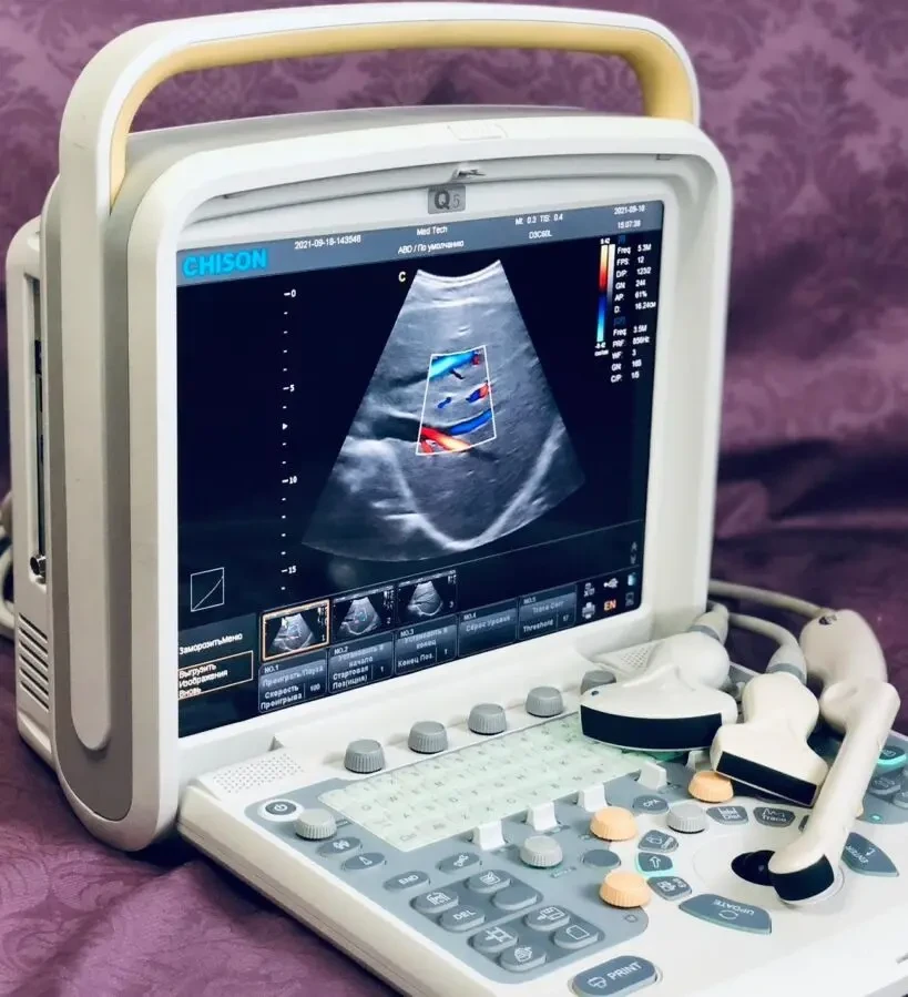 УЗИ УЗД CHISON Q5/ ЧІСОН/ 2013 РІК/ ДОПЛЕР/2 ДАТЧИКА