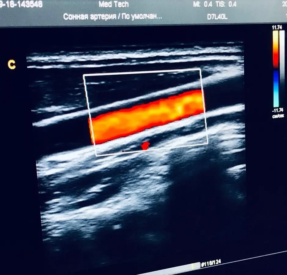 УЗИ УЗД CHISON Q5/ ЧІСОН/ 2013 РІК/ ДОПЛЕР/2 ДАТЧИКА 5