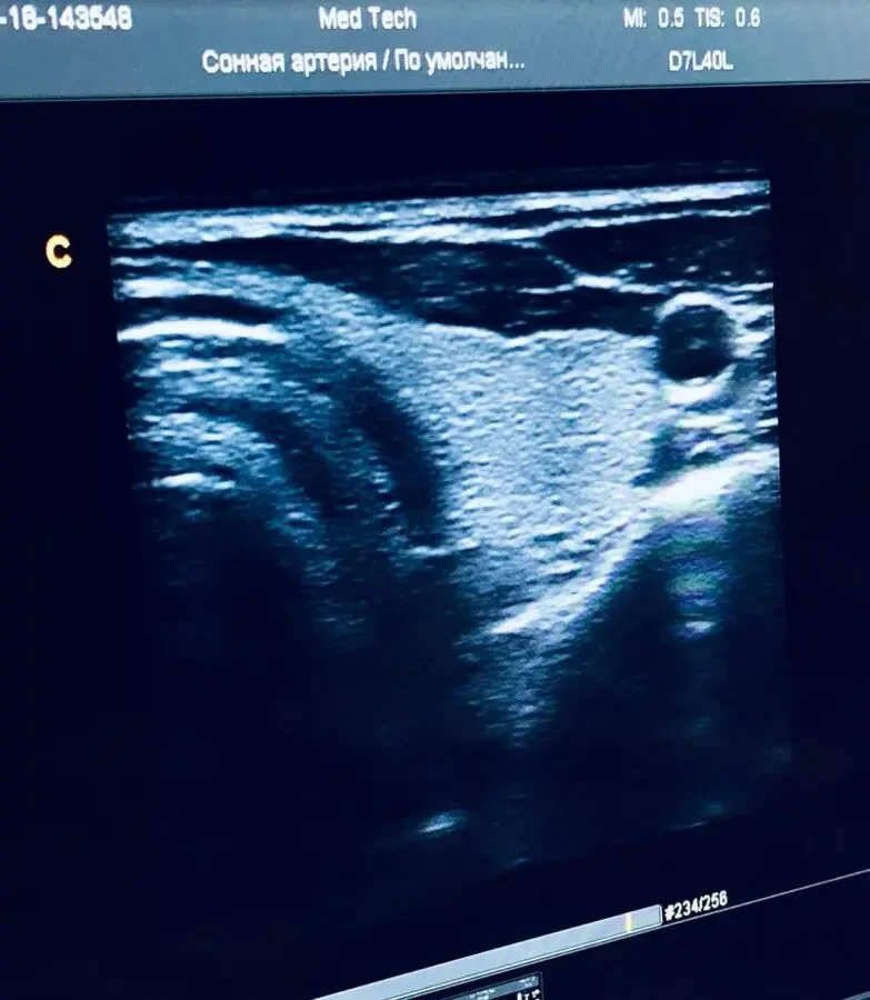 УЗИ УЗД CHISON Q5/ ЧІСОН/ 2013 РІК/ ДОПЛЕР/2 ДАТЧИКА 4