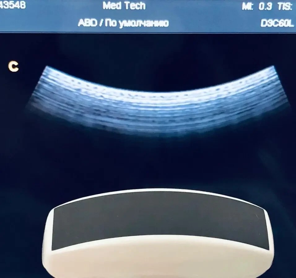 УЗИ УЗД CHISON Q5/ ЧІСОН/ 2013 РІК/ ДОПЛЕР/2 ДАТЧИКА 2