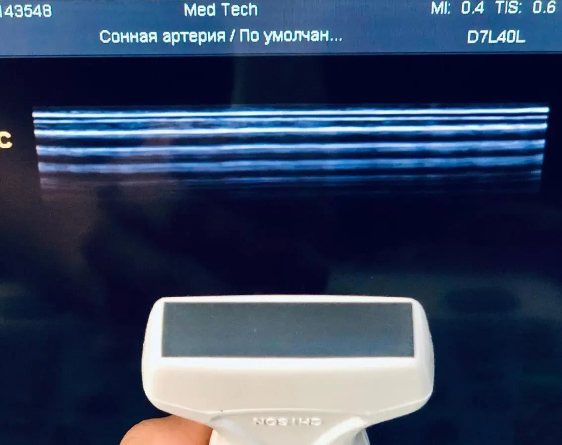 УЗИ УЗД CHISON Q5/ ЧІСОН/ 2013 РІК/ ДОПЛЕР/2 ДАТЧИКА 3