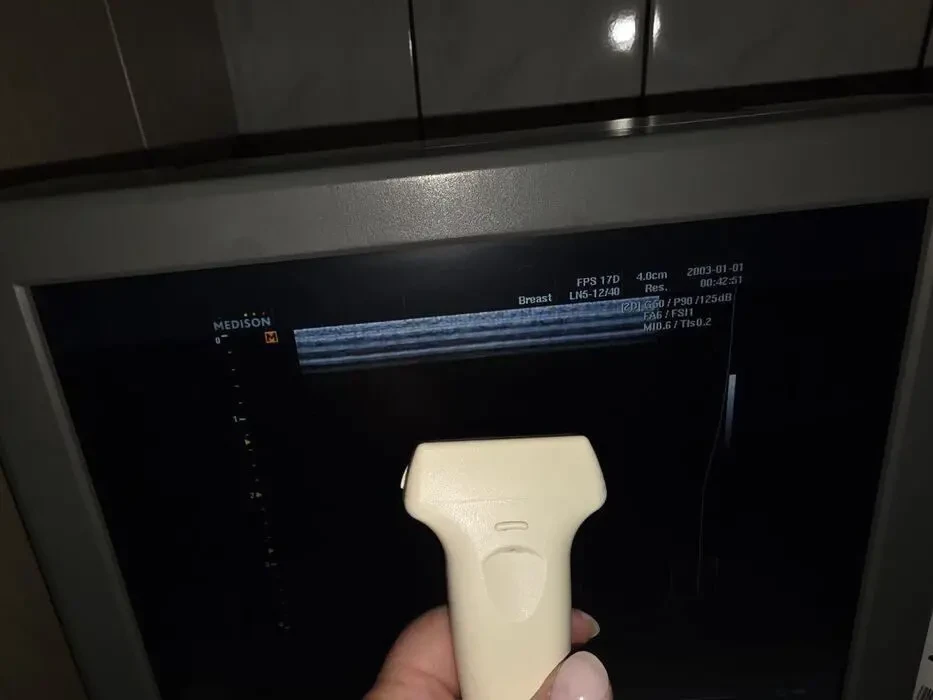 УЗИ УЗД Samsung Medison Sonoace R3/ 2013 рік Доплер/ 2 датчики 4