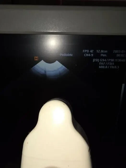 УЗИ УЗД Samsung Medison Sonoace R3/ 2013 рік Доплер/ 2 датчики 2