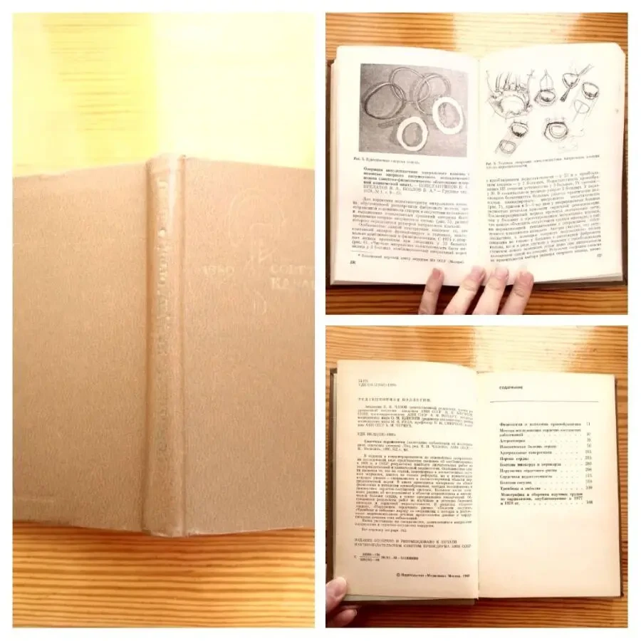 Книга кардиология. чазов, 1980 г, 352 с. для врача. студента медика 4