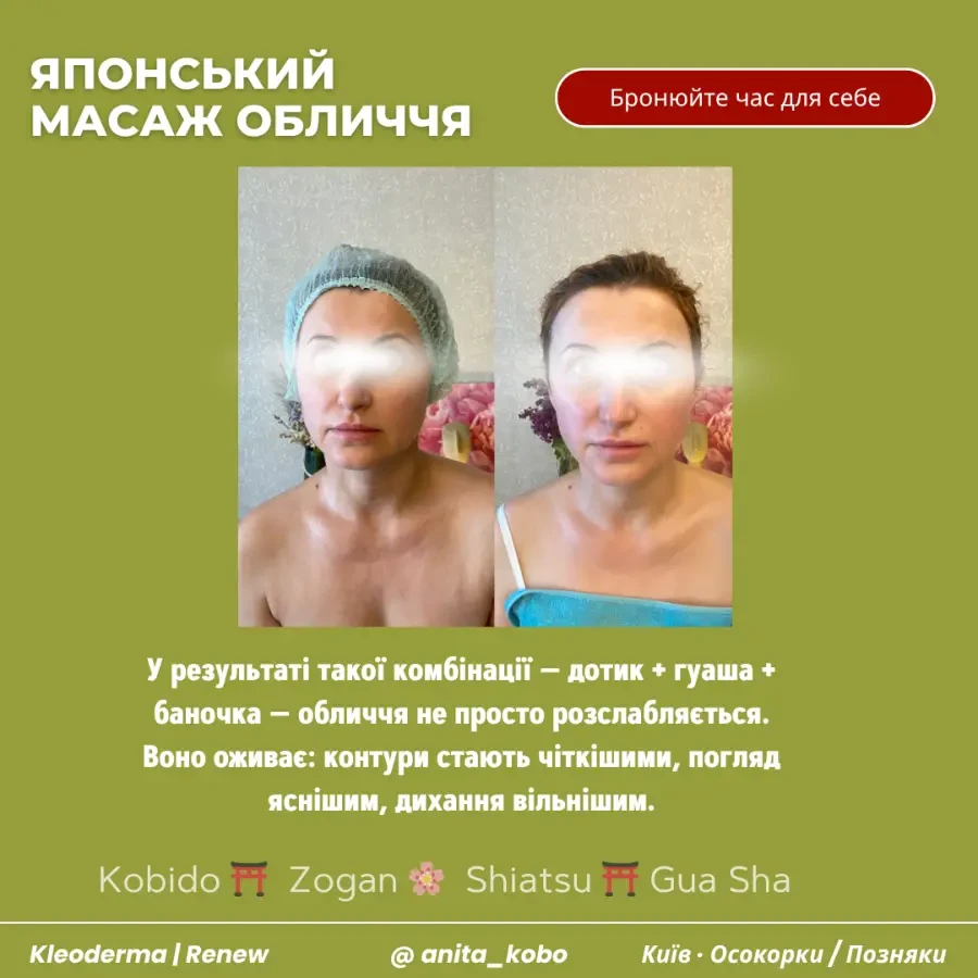 Моделюючий японський масаж обличчя Кобідо у Києві 3