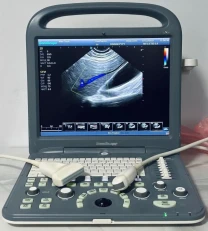 УЗИ/УЗД апарат SonoScape S2/ 2017/ 2x датчики/ Соноскейп