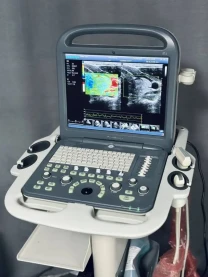 УЗИ/УЗД апарат SonoScape S2/ 2017/ 2x датчики/ Соноскейп