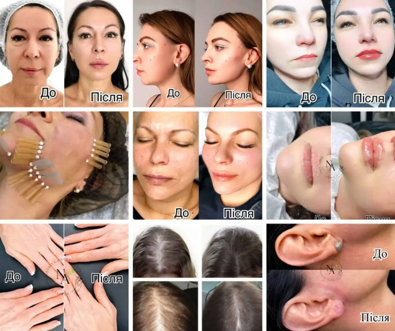 Косметолог - дерматолог Дніпро, Київ