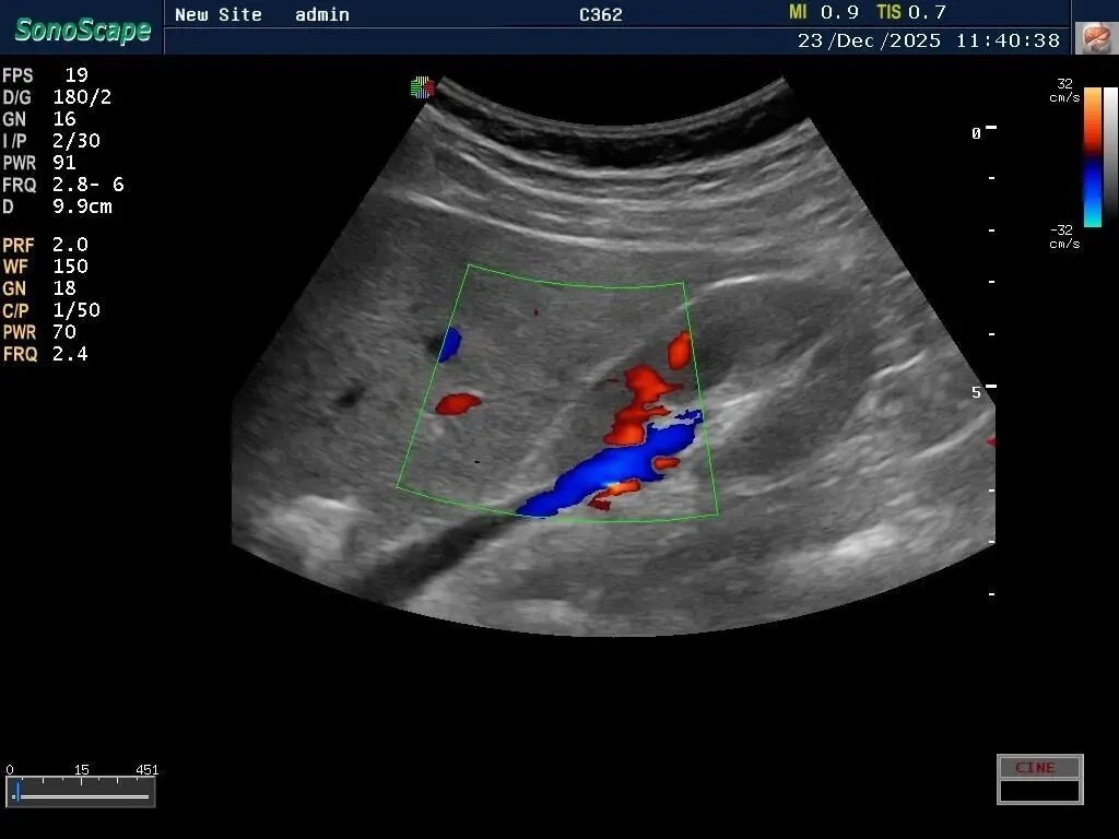 УЗИ УЗД апарат Sonoscape S6 Соноскейп 2 Датчики 4