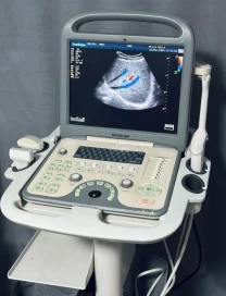 УЗИ УЗД апарат Sonoscape S6 Соноскейп 2 Датчики