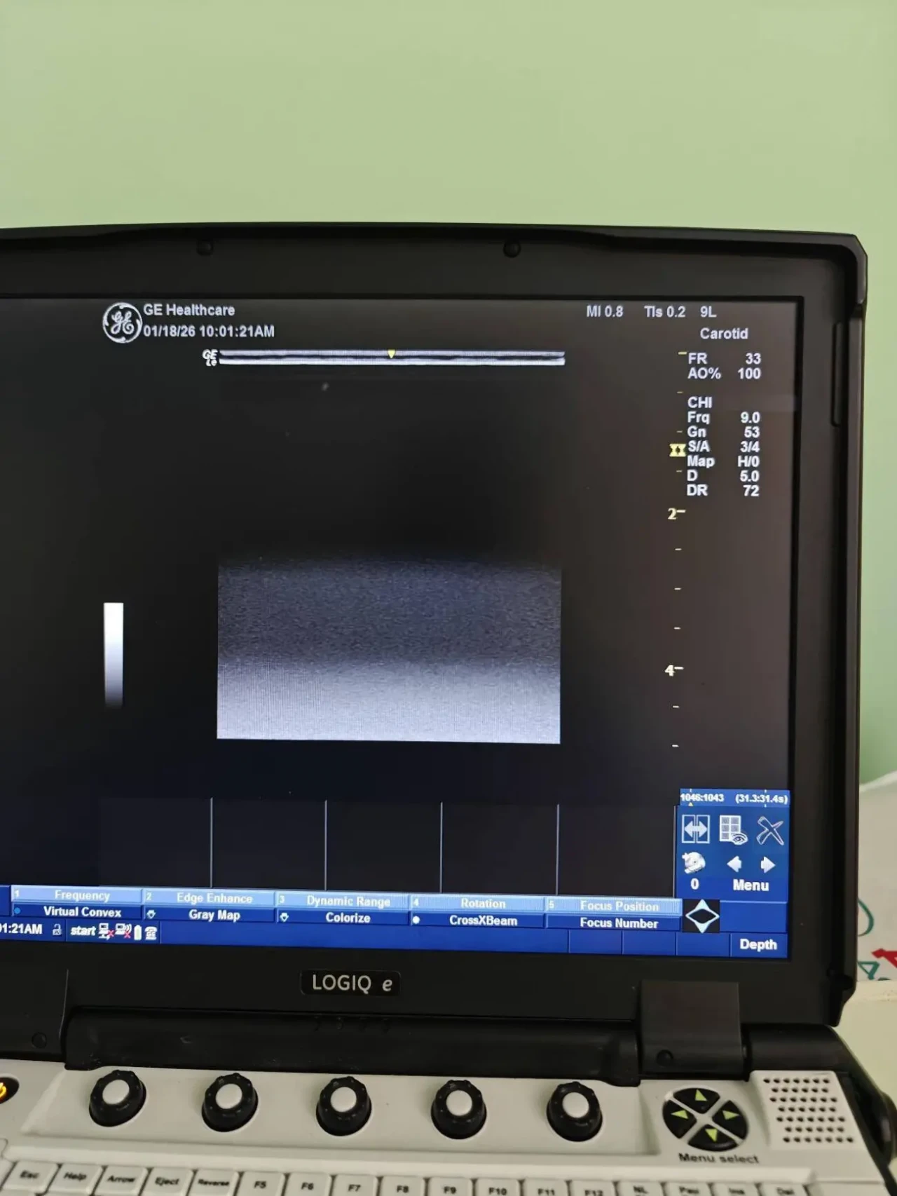 ДАТЧИК УЗИ УЗД ЛІНІЙНИЙ GE 9L-RS 2017 РОКУ ФОТО  ВІДЕО РОБОТИ/ 2