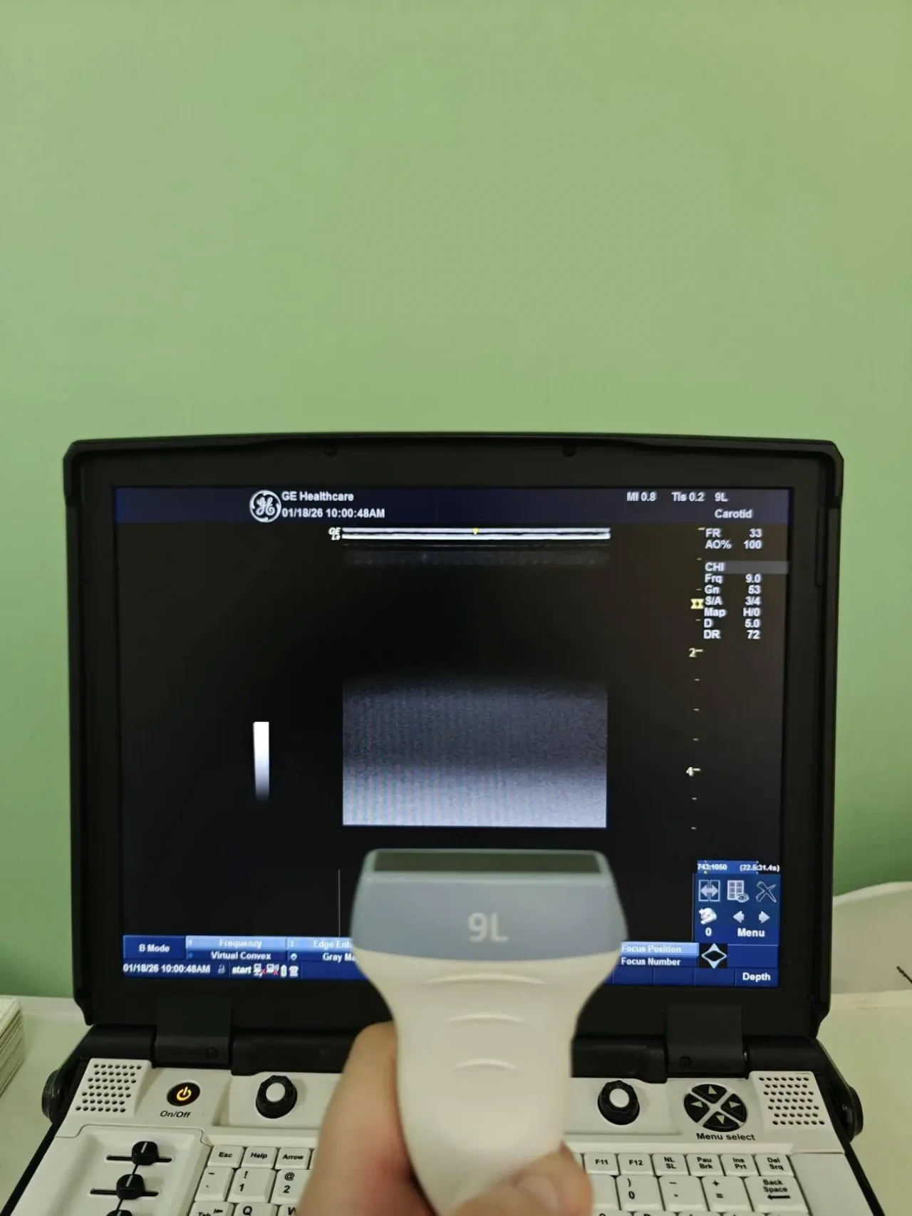 ДАТЧИК УЗИ УЗД ЛІНІЙНИЙ GE 9L-RS 2017 РОКУ ФОТО  ВІДЕО РОБОТИ/ 3