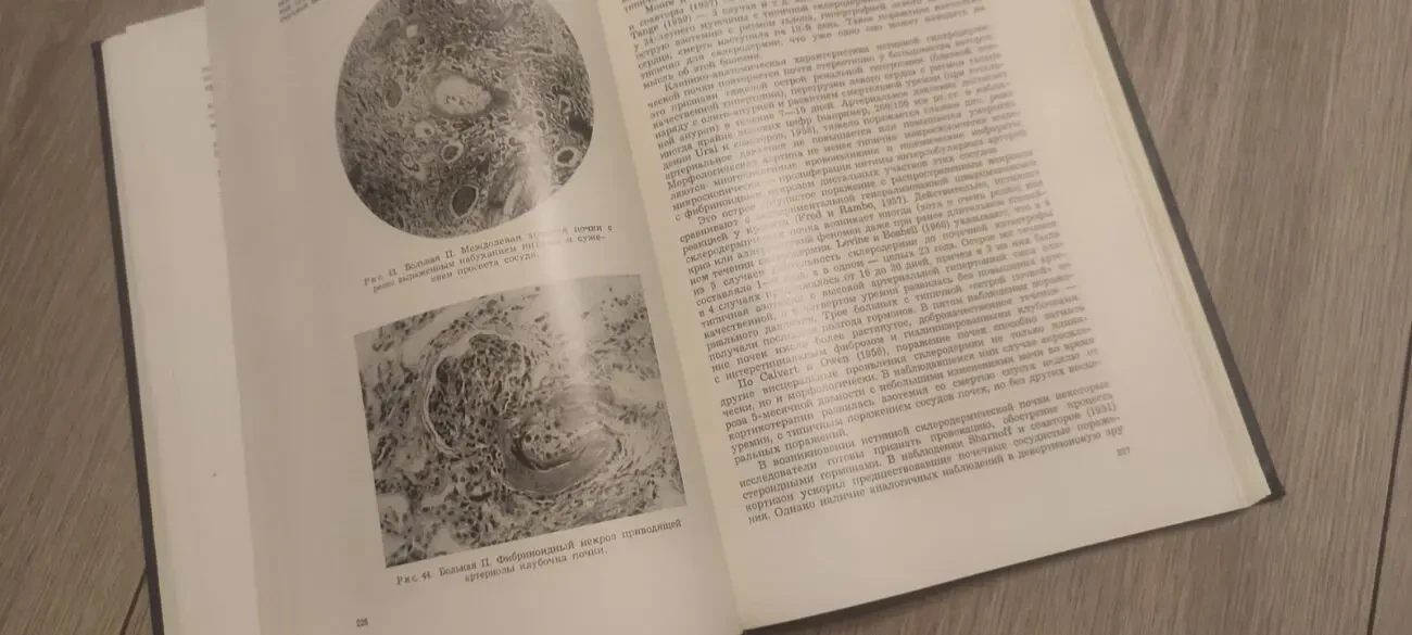 Тареев Е. М. Коллагенозы. 1965 7