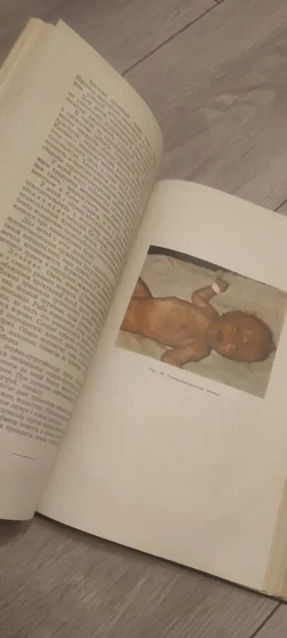 Проф. О. Д. Китайгородская. Учебник детских болезней 6