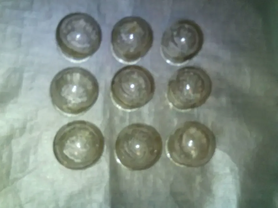 Лечебные банки.