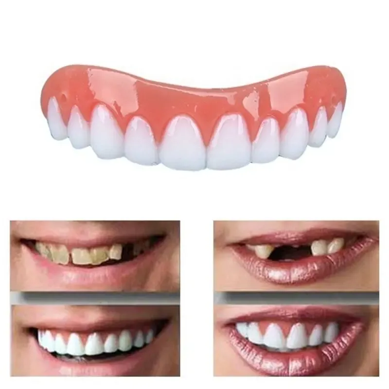 Виниры на зубы Perfect Smile Veneers 4