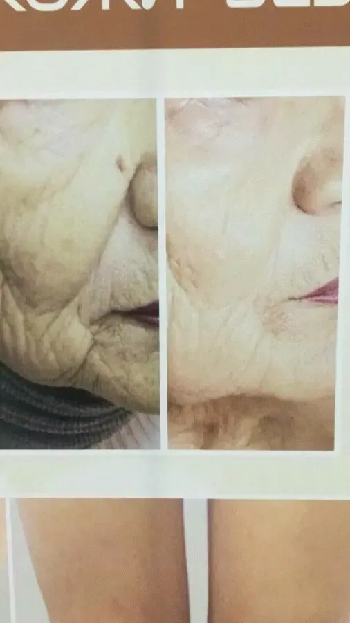 Біонергегетичний масажер для тіла(східна медицина) 5