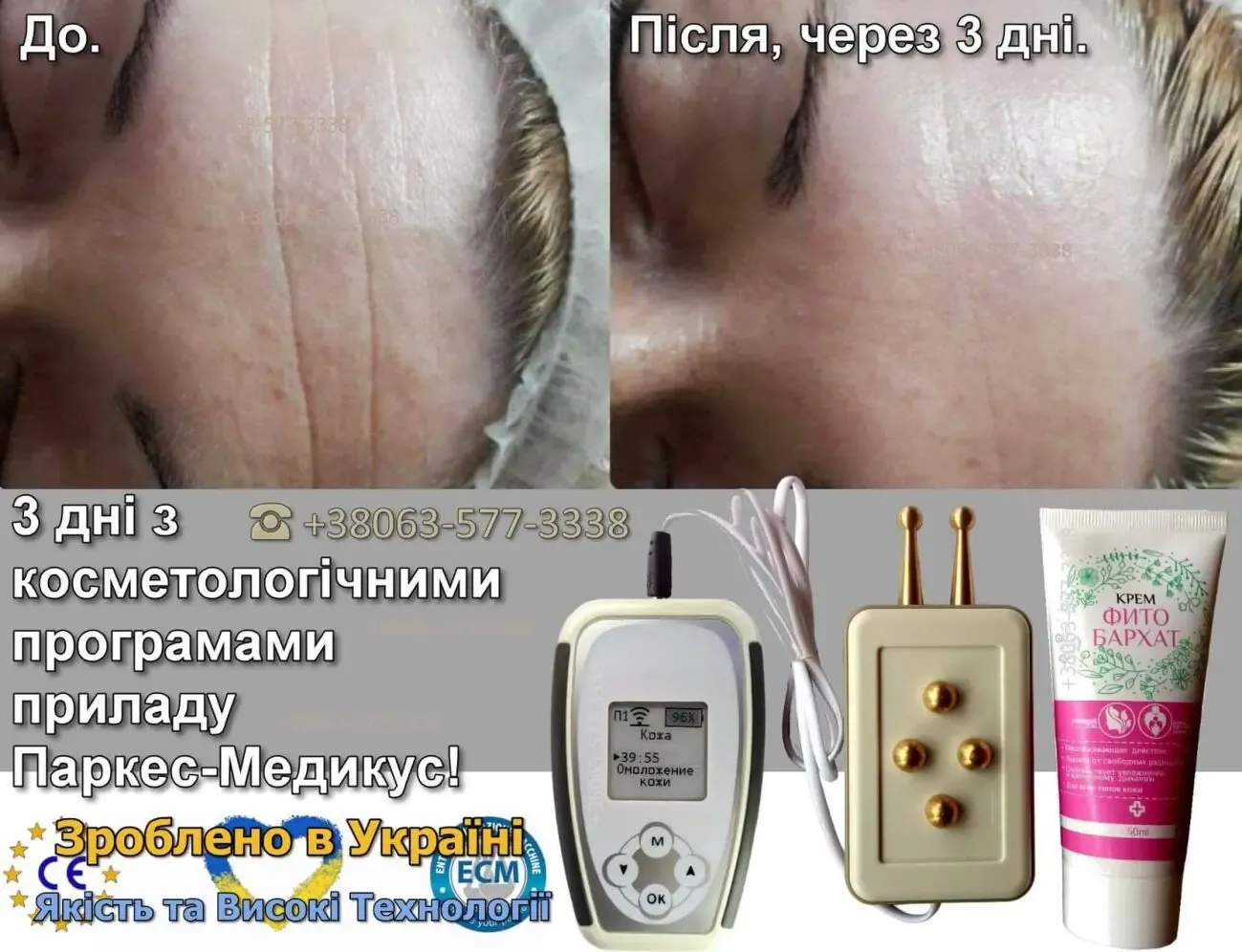 Личное лечебное частотное устройство Parkes-Medicus 7